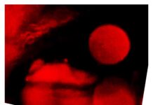 Oh Hazar – Justice